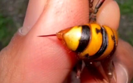 Bee: Your skin is so thick—this needle’s almost bent!
