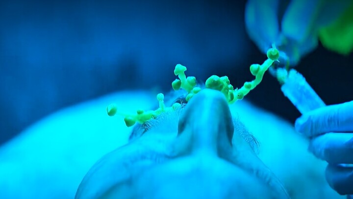 Bocah Temukan Cacing dalam Kapsul yang Dia Makan Tiap Malam, Investigasi Selanjutnya Ungkap Rahasia 