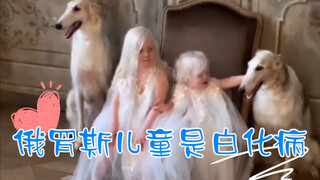 俄罗斯女子生下2个白化病孩子，眼睛是紫罗兰色的
