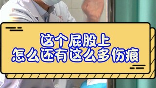 Tại sao lại có nhiều vết sẹo ở mông thế này?