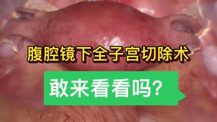 Proses lengkap pengangkatan rahim, berani nonton sampai selesai nggak?