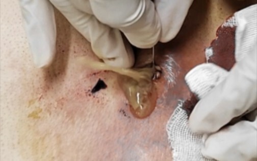 Núi lửa phun trào