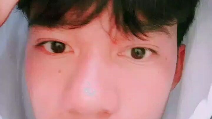 dimple