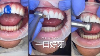 Learn more about dental bonding