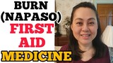 Burn (Napaso): Home Remedies- Payo ni Doc Liza Ramoso-Ong