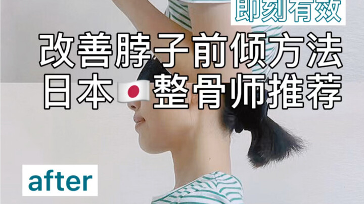 Phương pháp cải thiện tư thế cổ đưa ra trước / Được bác sĩ nắn xương Nhật Bản khuyên dùng