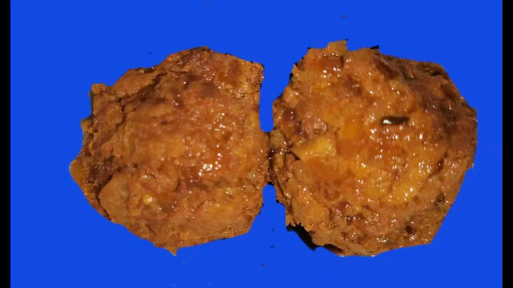 Two oddly shaped meatballs. bb