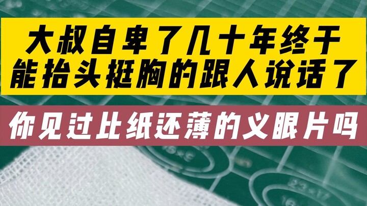 Guess which eye the uncle is wearing a prosthetic eye in!