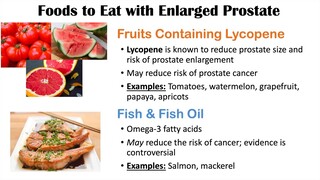 Best Foods to Eat with Enlarged Prostate  Reduce Risk of Symptoms, Enlargement &