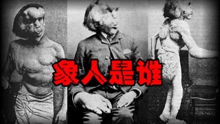 【象人传奇】被剥夺人生的畸形者，真正的悲惨人生