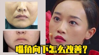 How to improve the downturned corners of the mouth?