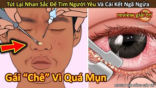 Nhím Cute Review thanh niên bị chê vì quá mụn và cái kết Hối Không Kịp || Review Giải Trí Đời Sống