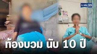 ทุกข์ทรมานเกือบ 10 ปี สาวลาวท้องบวม | เกาะข่าวเที่ยง | GMM25