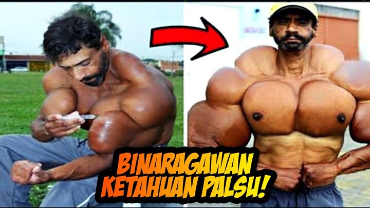 Saking Palsu Otot Binaragawan Ini, Dirinya Sampai Hampir Diamputasi dan Hidupnya Diejek2 Netizen!