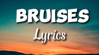 Bruises Lewis Capaldi -( Lyrics )