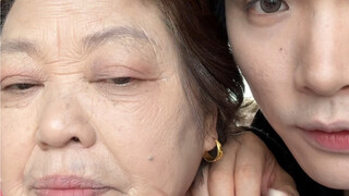 Regarding nasolabial fold concealer, I won’t come to your house.