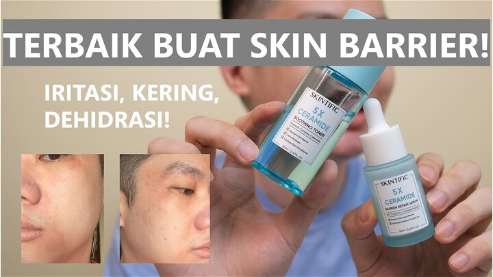 Review SKINTIFIC 5X Ceramide Soothing Toner & Barrier Repair Serum | Skin Barrier Saviour.