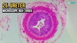 25. Ureter (Microscope 40x-1000x)