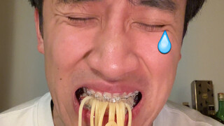 Who knows the pain of having an overbite? It's so big that I can't even eat noodles!!!
