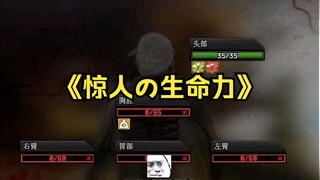 เมื่อร่างกายของคุณเน่าเปื่อยเหลือเพียงศีรษะเดียว...