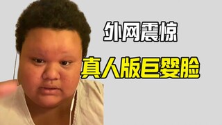 外网震惊真有人长着像巨婴
