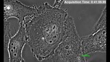 HeLa cell, Live cell imaging, Cell division, Mitosis, Time lapse, Phase contrast microscopy.