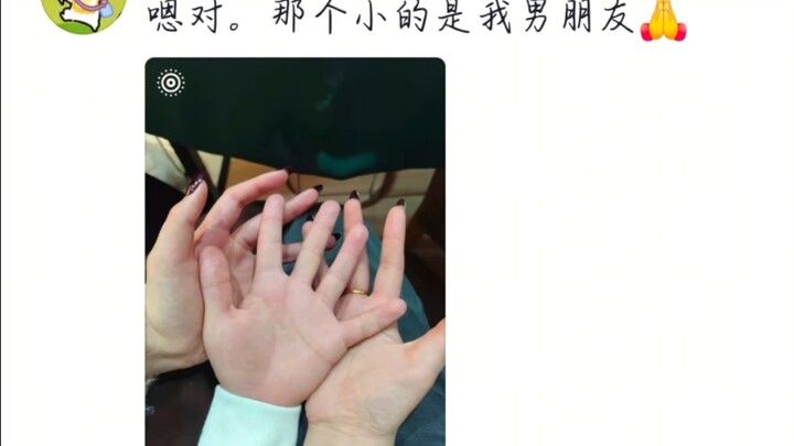 What’s it like when your hands look totally different from the rest of you?