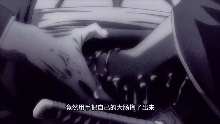 ชายคนนั้นเอาลำไส้ใหญ่ของเขาออกด้วยมือของเขาจริงๆ