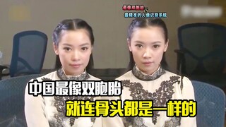 中国最像双胞胎，就连骨头都是一样的