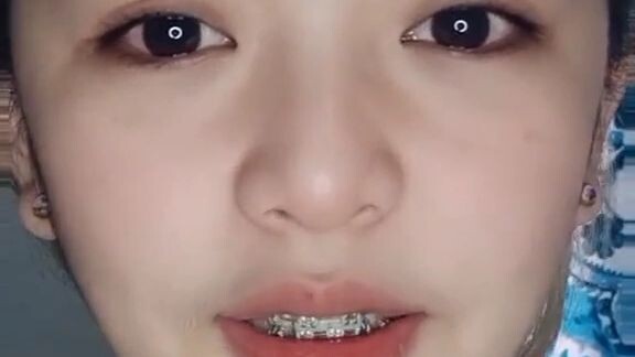 🥺🥺