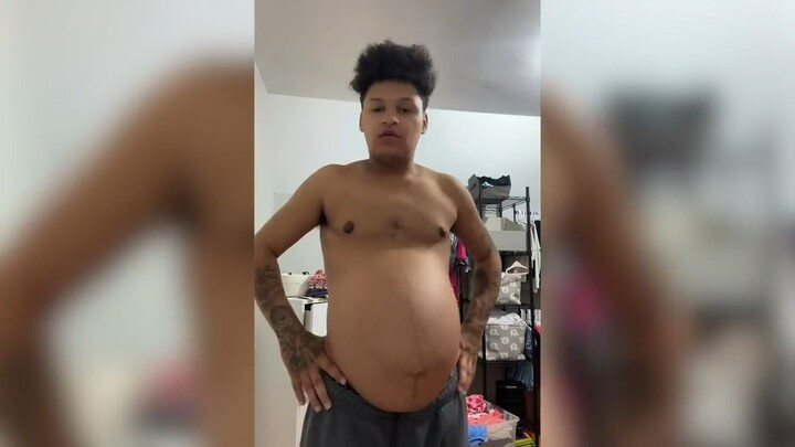 Pregnant Dad At 19 - People Thought My Belly Was ‘AI’ | MY EXTRAORDINARY FAMILY