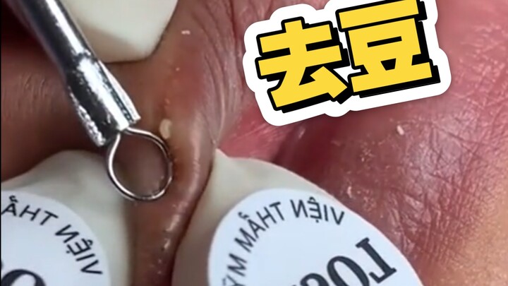 اذهب إلى دوو