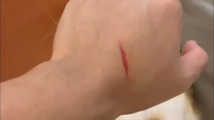 ถ้าโดนแมวข่วนอย่าดึงมือออก ไม่อย่างนั้นจะยิ่งเจ็บหนักกว่าเดิม