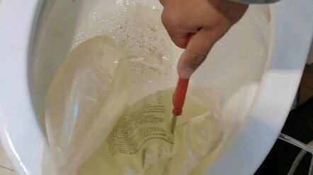 Thói quen lọc màng bụng hàng ngày. Sáng nay sau khi thay dịch xong, mình ăn một bát mì trộn do chính
