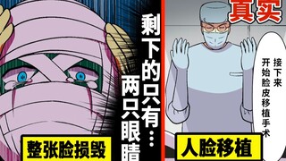 夺走他人的脸皮...通过脸皮移植手术改变人生的男人