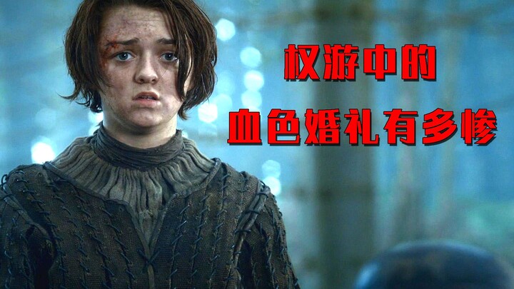Đám cưới đỏ trong Game of Thrones bi thảm đến mức nào? Anh trai của Arya bị khâu đầu sói lên đầu, và