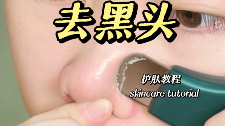 Tutorial paling ampuh untuk menghilangkan komedo