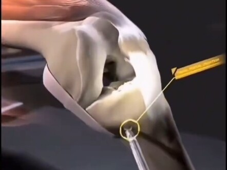 I’ve completely transformed!