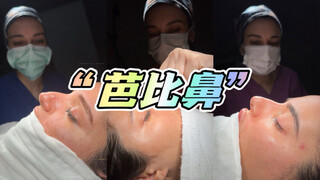 Operasi plastik "hidung Barbie" yang mendapat ulasan buruk sekali di platform sosial Tiongkok 😰