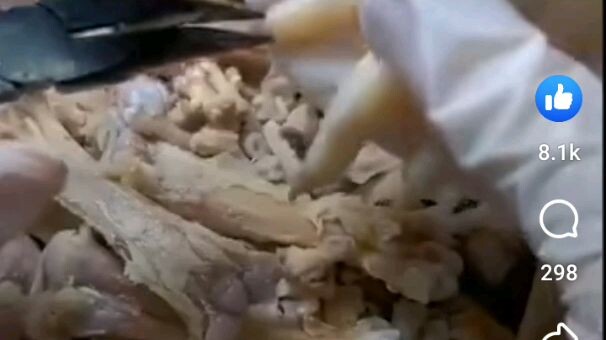 paraan ng pag aalis ng buto