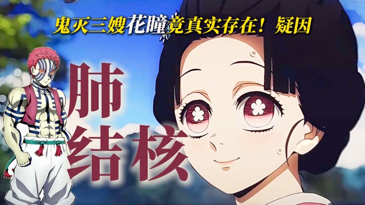 The Snowflake Eyes of Tamayo, the third sister-in-law from "Demon Slayer," actually exist in real li