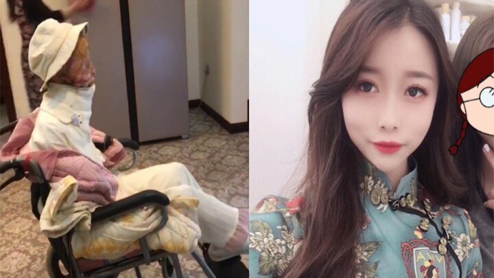 因汽车爆炸女孩全身重度烧伤，晒康复程惹泪目：熬过了最苦的几年