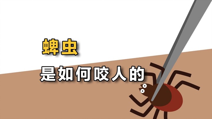 蜱虫是如何咬人的