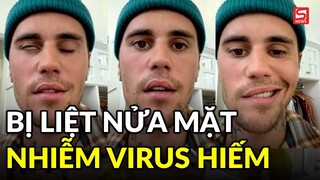 Justin Bieber bị liệt nửa mặt do nhiễm virus hiếm