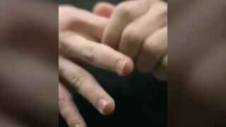 Banyak orang suka mematahkan jari mereka hingga terdengar "krek-krek", apakah gerakan ini berbahaya 