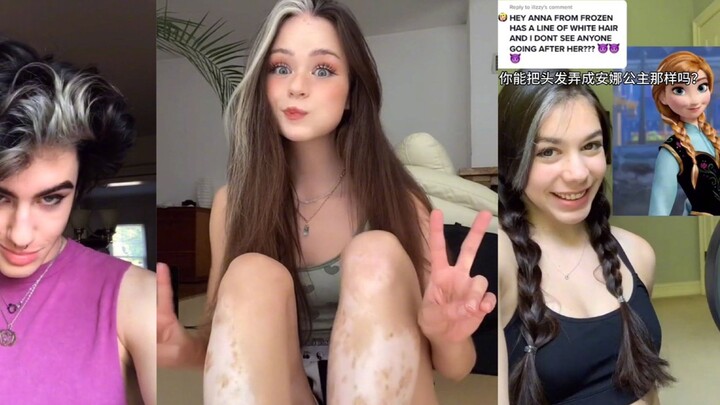 Bagaimana rasanya terlahir dengan rambut putih alami...