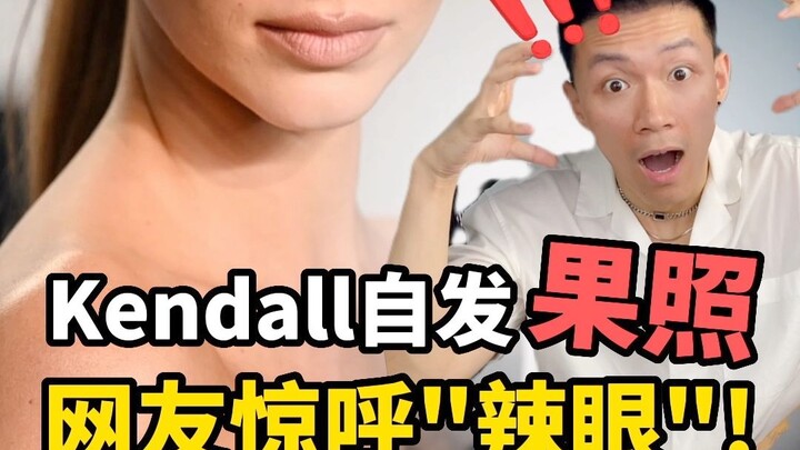 عارضة الأزياء الشهيرة كيندال تنشر صورة فاكهة، والمستخدمون يصرخون "مزعجة للعين!"