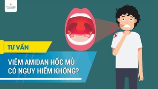 Viêm amidan hốc mủ có nguy hiểm không?