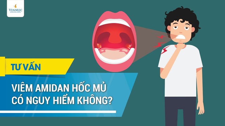 Viêm amidan hốc mủ có nguy hiểm không?