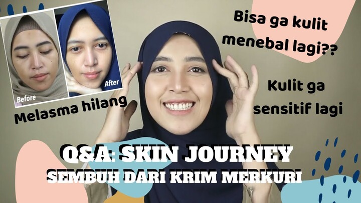 Q&A: MY SKINCARE JOURNEY, SEMBUH TOTAL DARI KRIM MERKURI + SKINCARE APA AJA YANG DIPAKAI